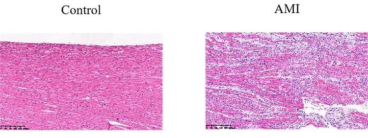 動物模型丨創新性SD雄性大鼠動物模型—心肌梗死模型!(圖1) 333.jpg